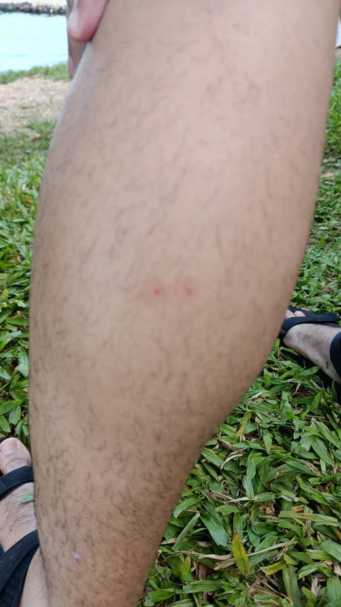 Homem é socorrido após suspeita de picada de cobra em trilha na Costa da Lagoa, em Florianópolis