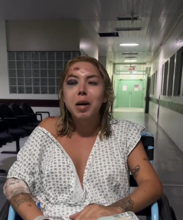 Mulher denuncia atropelamento por motorista de aplicativo após discussão sobre pagamento em Florianópolis